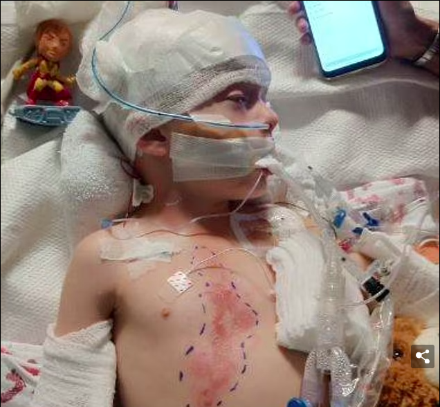 Young Boy Loses Battle after Lightning Incident